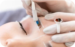 施術をしている様子